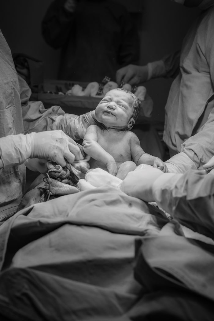 services-img A newborn baby in a hospital delivery room, surrounded by medical practitioners during childbirth.
